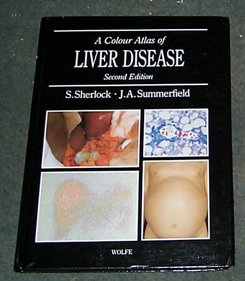 Image for COLOUR ATLAS OF LIVER DISEASE, A - SECOND EDITION